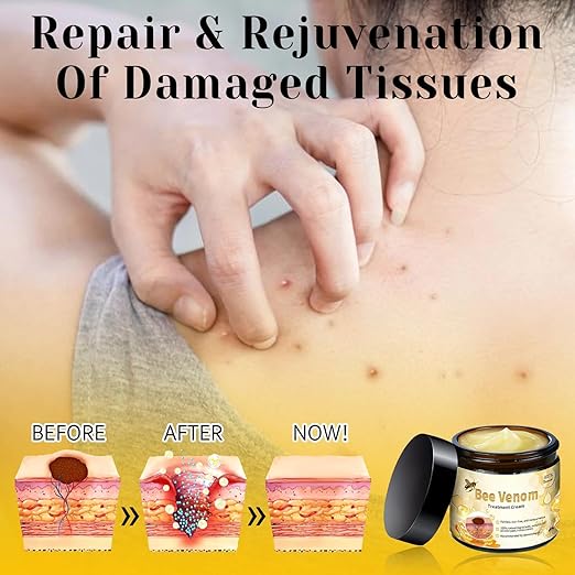 Bee Venom Cream for All Body Parts كريم سمّ النحل لجميع أجزاء الجسم