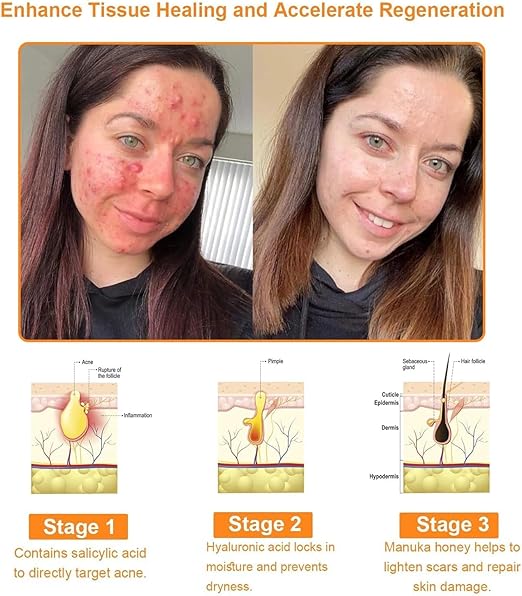 Bee Venom Cream for All Body Parts كريم سمّ النحل لجميع أجزاء الجسم