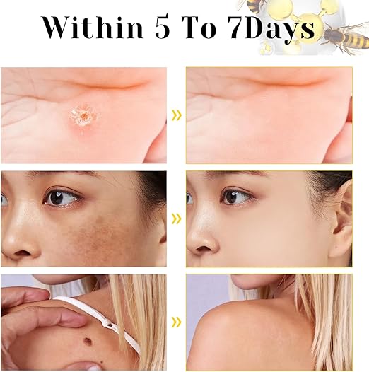 Bee Venom Cream for All Body Parts كريم سمّ النحل لجميع أجزاء الجسم