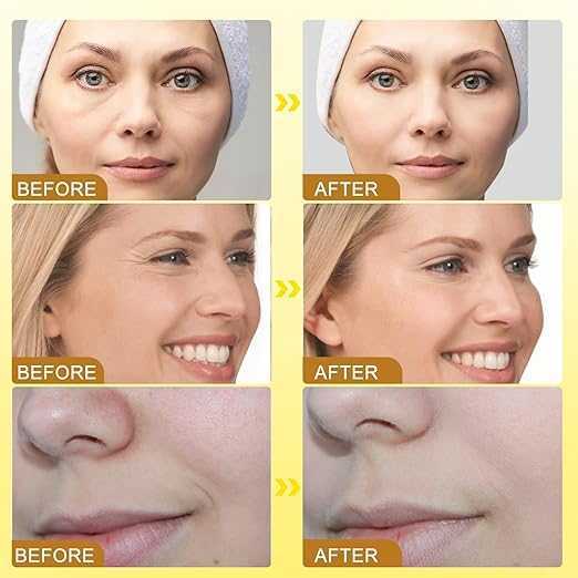 Botox Bee Venom Cream كريم سم النحل بتأثير البوتوكس