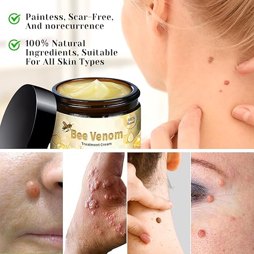 Bee Venom Cream for All Body Parts    كريم سمّ النحل لجميع أجزاء الجسم